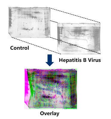 Figure 1.  Two-Dimensional (2D) Gel Analysis