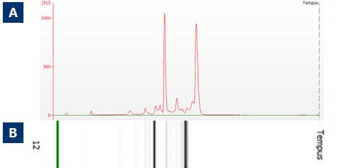 Figure 1. Isolation of High Quality Total RNA