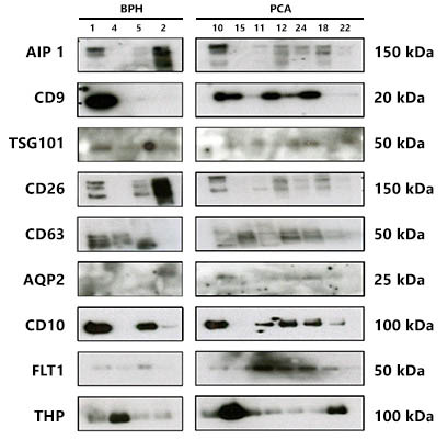 Figure 6. Urine Exosome RNA Isolation Kit