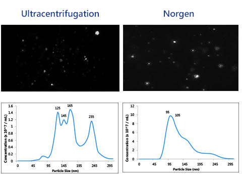 Figure 3. Urine Exosome Purification and RNA Isolation Mini Kit