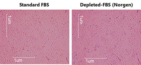 Figure 2. FBS Exosome Depletion Kit (Slurry Format) 