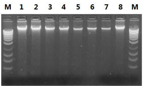 Figure 5. Resolution of DNA Isolated from Preserved Saliva Samples