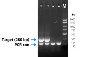 Figure 4. HPV (High and Low Risk) End-Point PCR Kit