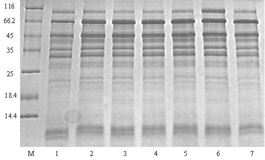 Figure 2. Consistent Protein Purification from 1 mL Urine Samples  