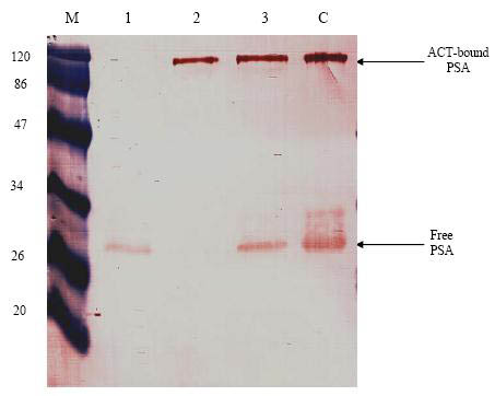 Figure 3. Western Blot Showing the Recovery of Proteins Spiked into Urine