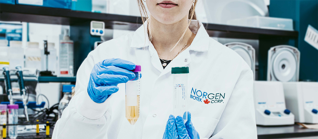 scientist holding urine collection tube