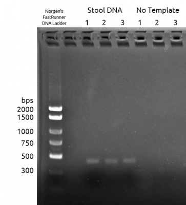 Figure 1: 16S V4-V5 PCR1 Amplification