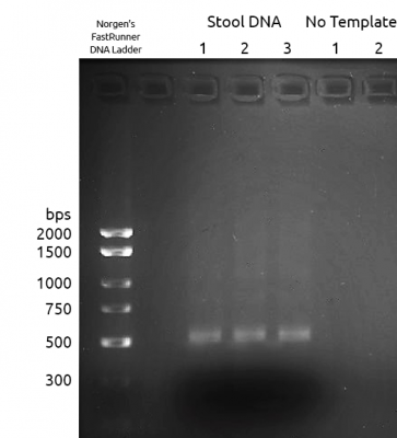 Figure 1: 16S V2-V3 PCR1 Amplification