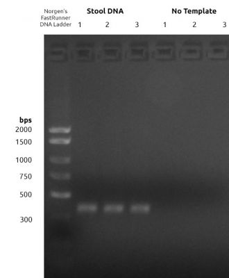 Figure 1: 16S V4 PCR1 Amplification