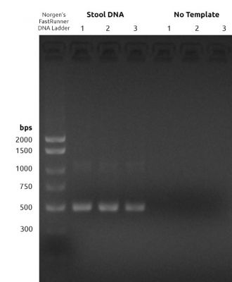 Figure 1: 16S V5-V7 PCR1 Amplificatio