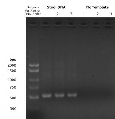 Figure 1: 16S V7-V9 PCR1 Amplification