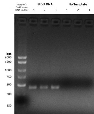 Figure 1: 16S V1-V2 PCR1 Amplification