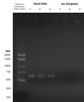 Figure 1: 16S V1-V3 PCR1 Amplification