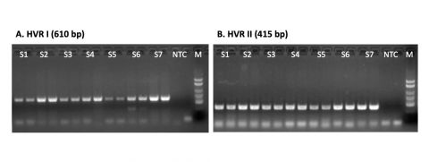 Figure 1. PCR amplification of mitochondrial DNA Hyper Variable Region (HRV) from seven hair shaft samples (S1-S7)