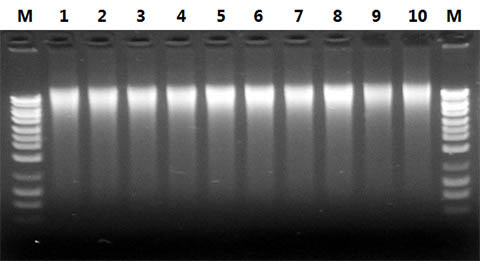 Figure 4. High Yields of DNA Isolated from Saccharomyces cerevisiae overnight culture