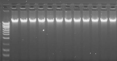 Figure 13. High Yields of DNA Isolated from 200 µL of Whole Blood