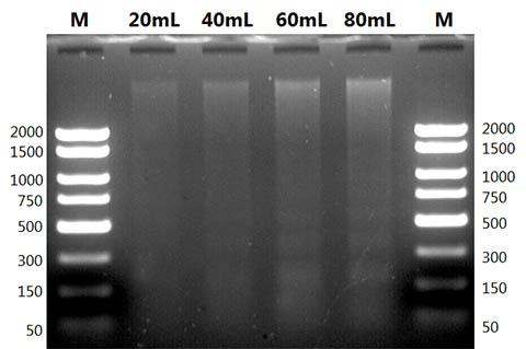 Figure 7. Total Urinary DNA Isolated from Different Urine Volumes