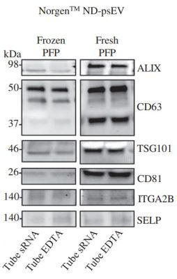 Figure 4. Western blot analysis of plasma small EVs (psEV)