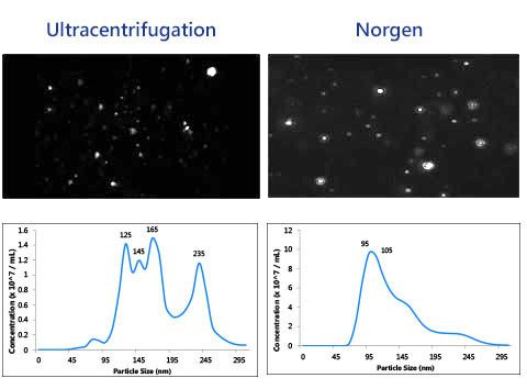 Figure 2. Intact Exosomes were purified from 10 mL urine using Norgen’s Urine Exosome Purification Midi Kit (Cat# 57800) and Ultracentrifugation. 