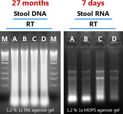 Figure 2. High Integrity of Preserved DNA and RNA