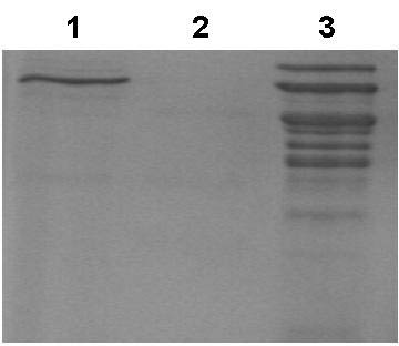 Figure 6. No Loss of Urine Proteins