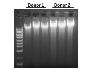 Figure 2. Resolution of DNA isolated from buffy coats using Norgen's Blood Genomic DNA Isolation Mini Kit