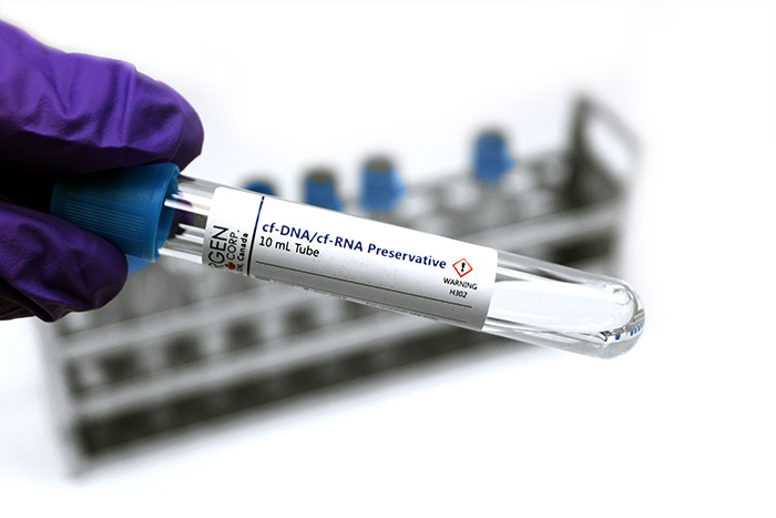 Liquid Biopsy Plasma/Serum Workflow