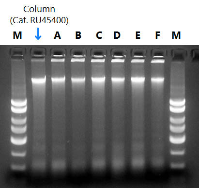 Figure 1. Resolution of DNA isolated from Preserved Saliva Samples.