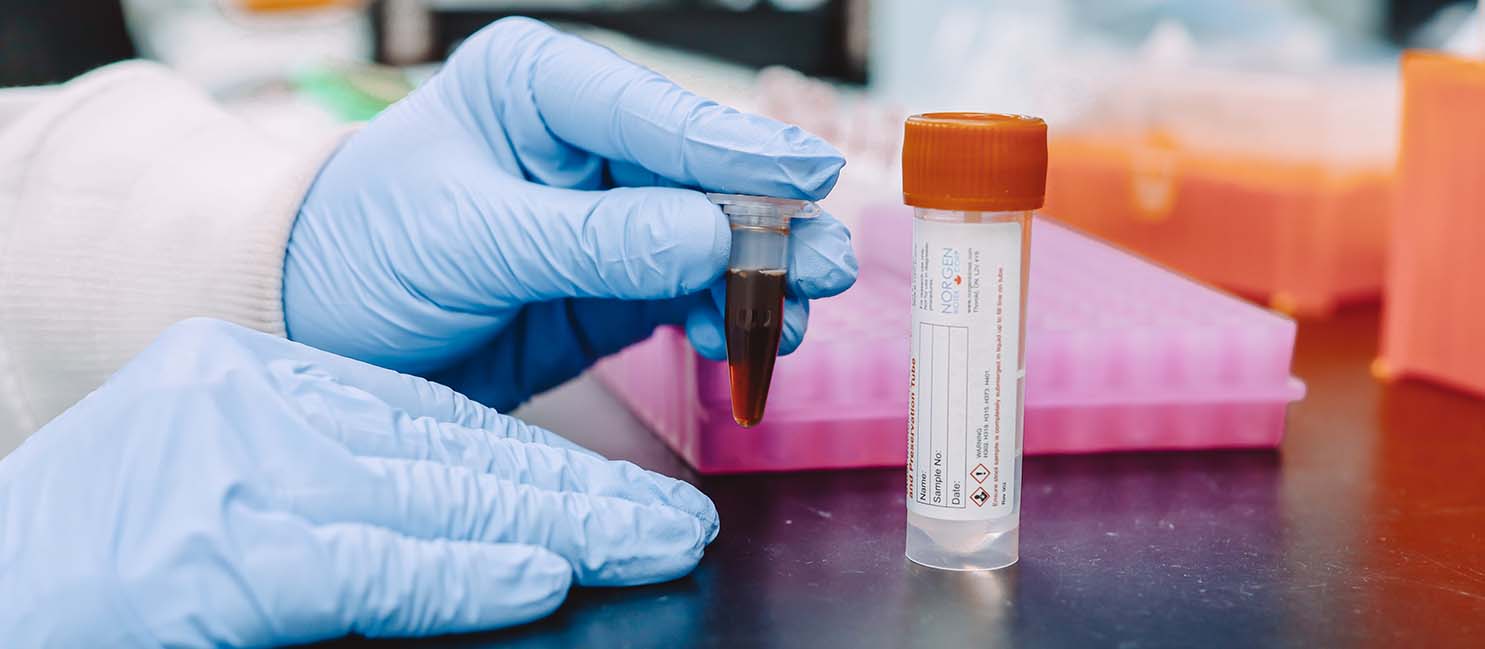 fecal sample in centrifuge tube